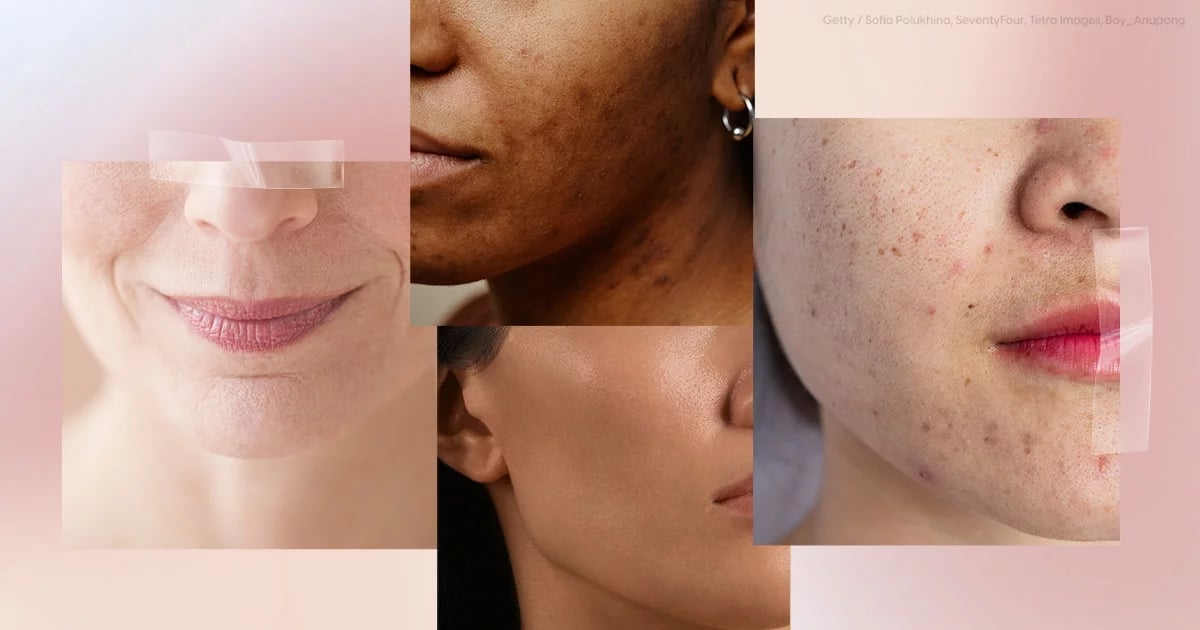 what-is-your-skin-type?-take-this-easy-quiz-to-find-out