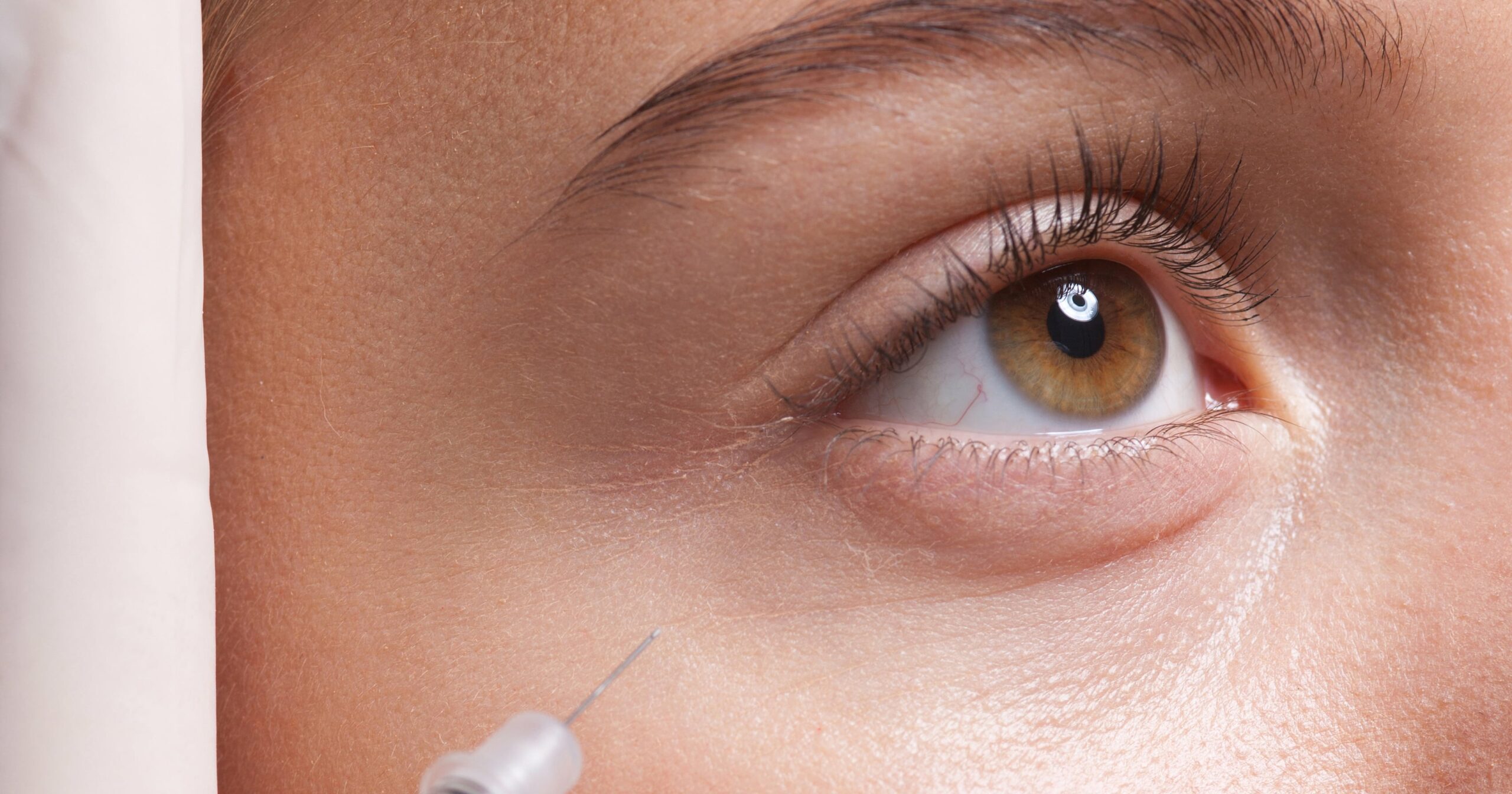 this-new-dermal-filler-is-the-first-to-be-fda-approved-for-the-undereye-area