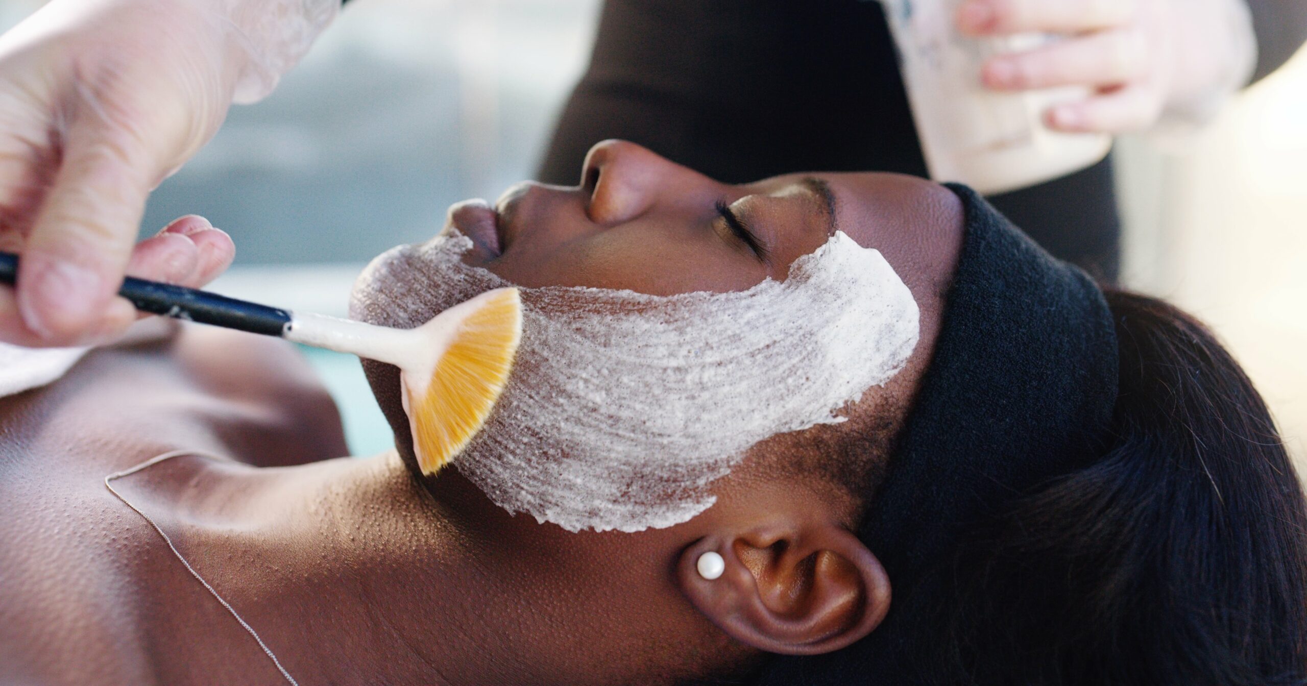 everything-you-should-know-about-chemical-peels