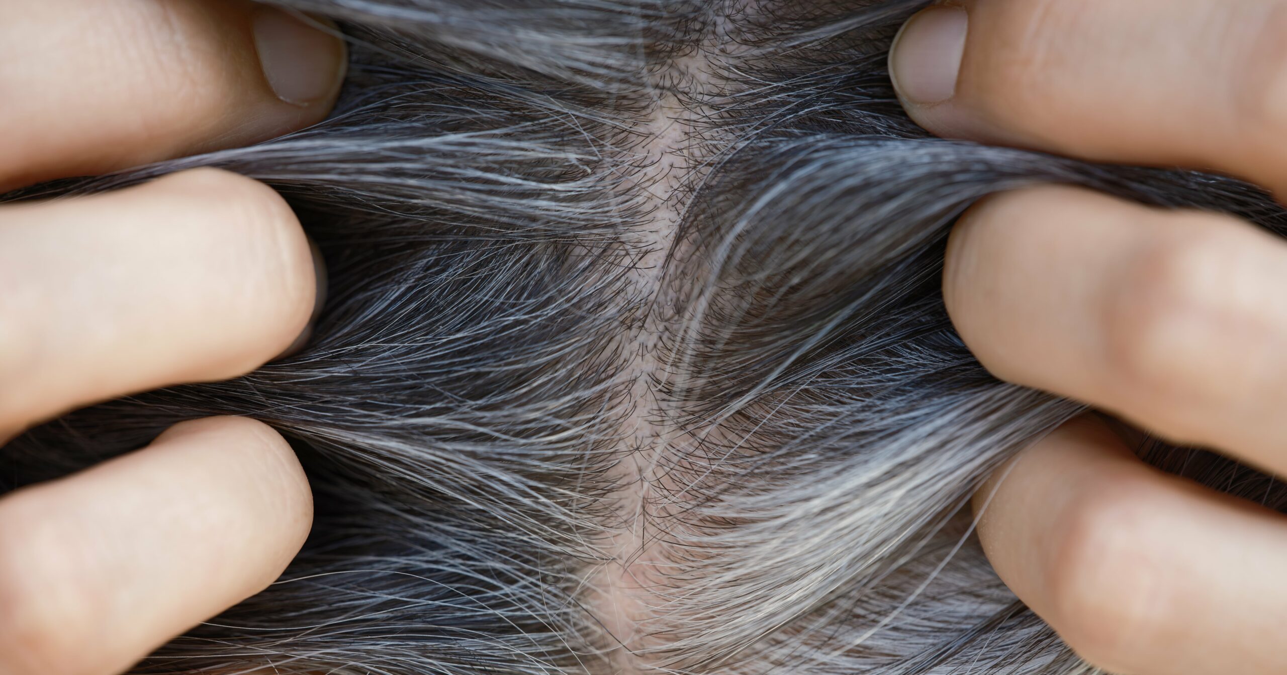 does-stress-really-make-your-hair-turn-gray?