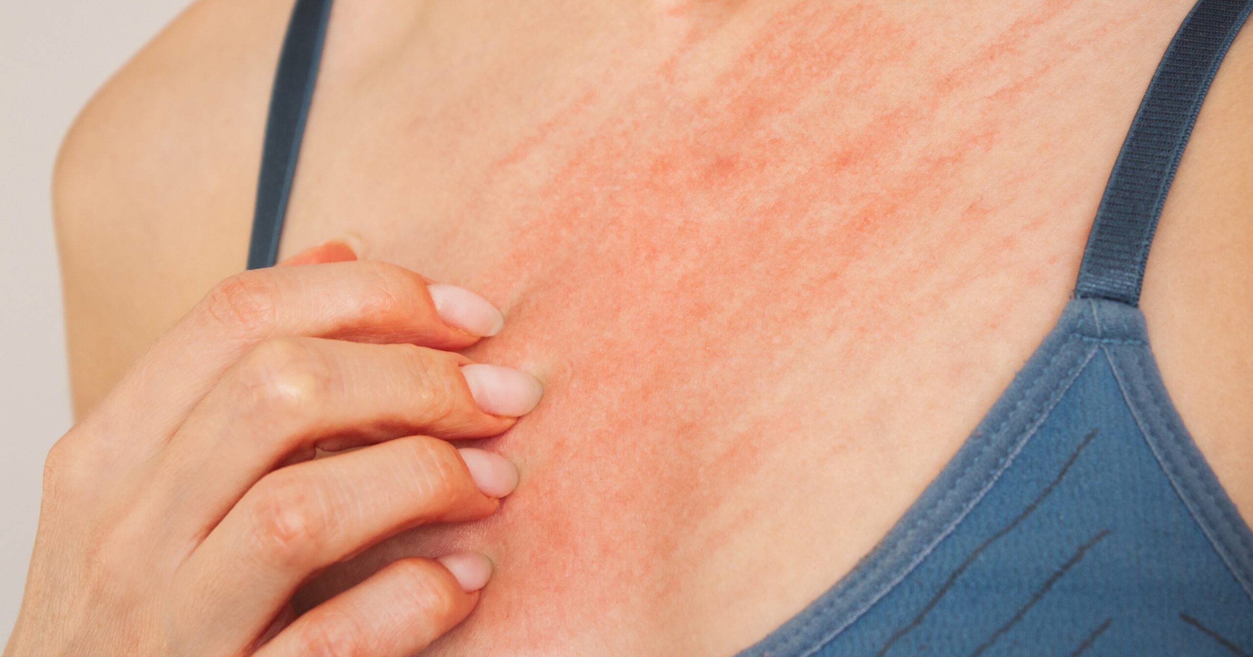 itchy-nipples?-here-are-9-potential-causes