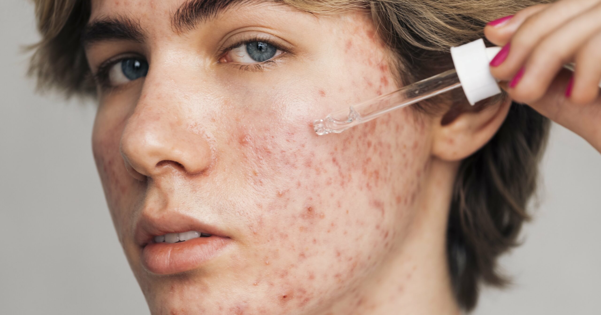 how-to-unclog-your-pores,-according-to-dermatologists-and-aestheticians