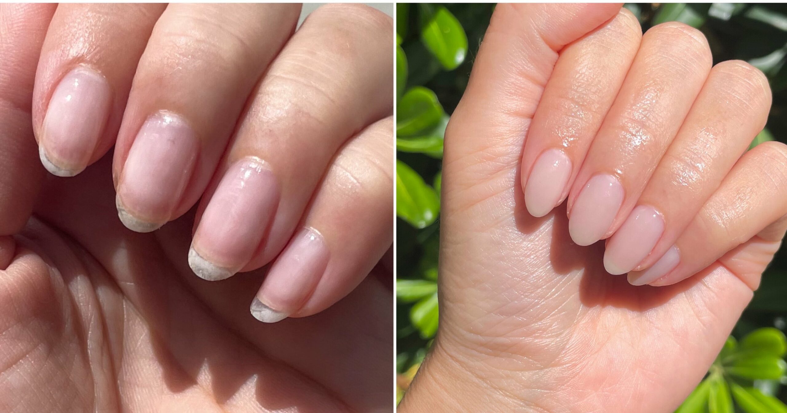 “nail-cycling”-helped-me-repair-months-of-damage