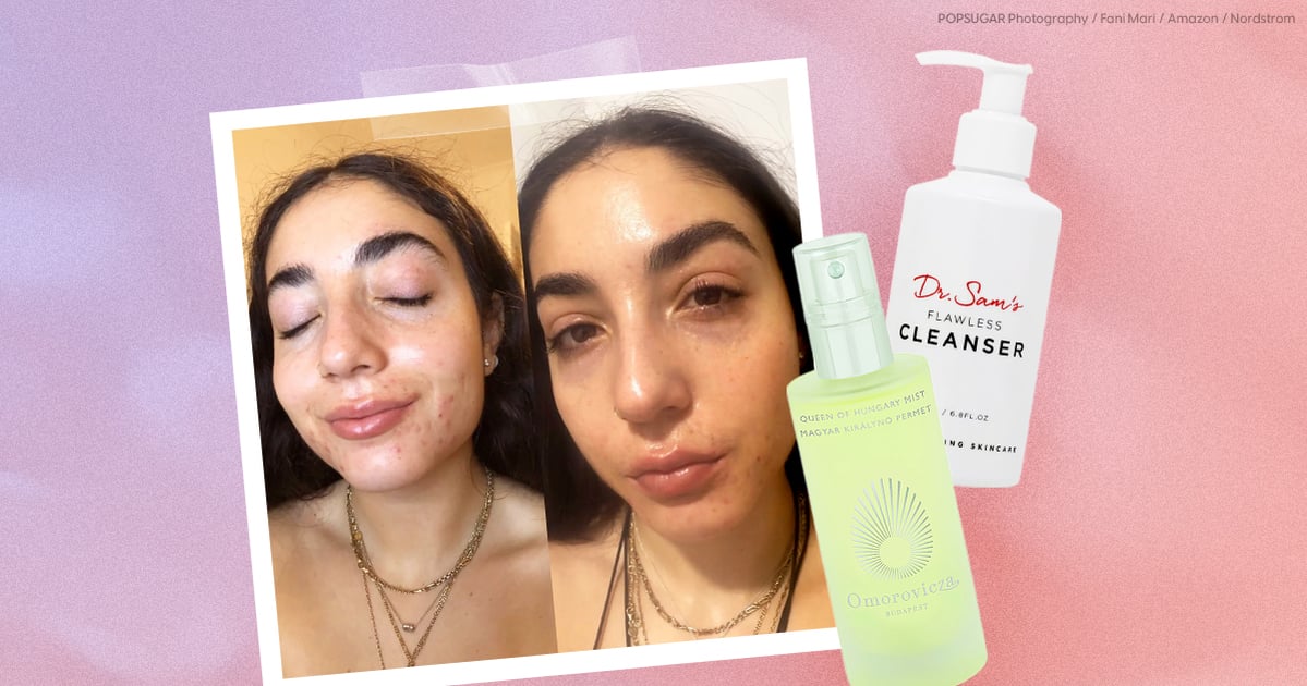 i’m-on-accutane,-and-these-are-the-products-saving-my-dry-skin