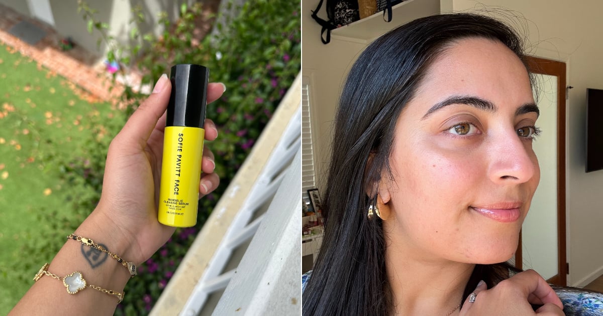 this-mandelic-serum-worked-to-fade-my-dark-spots-in-just-5-weeks