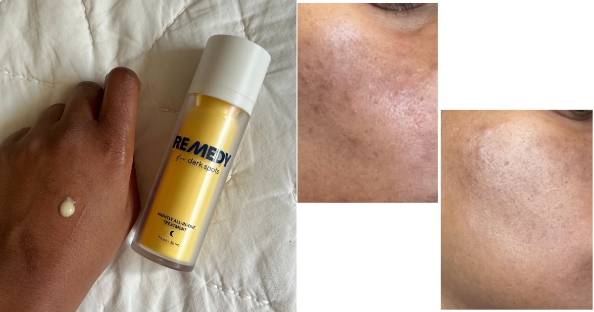 this-$38-serum-faded-my-dark-spots-in-just-a-month