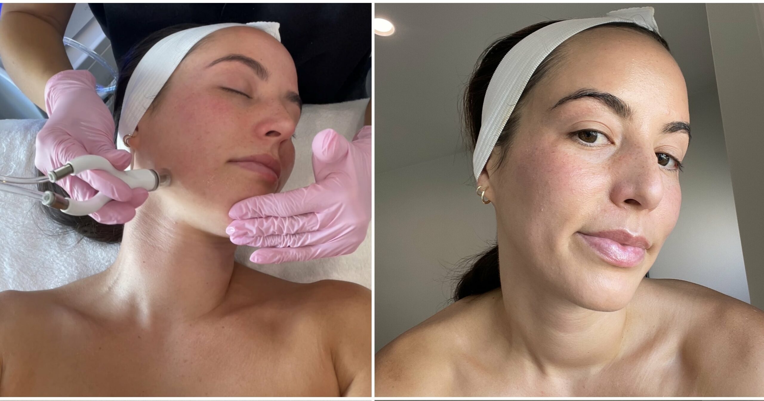 i-tried-a-$200-celeb-loved-facial,-and-my-skin-has-never-looked-better