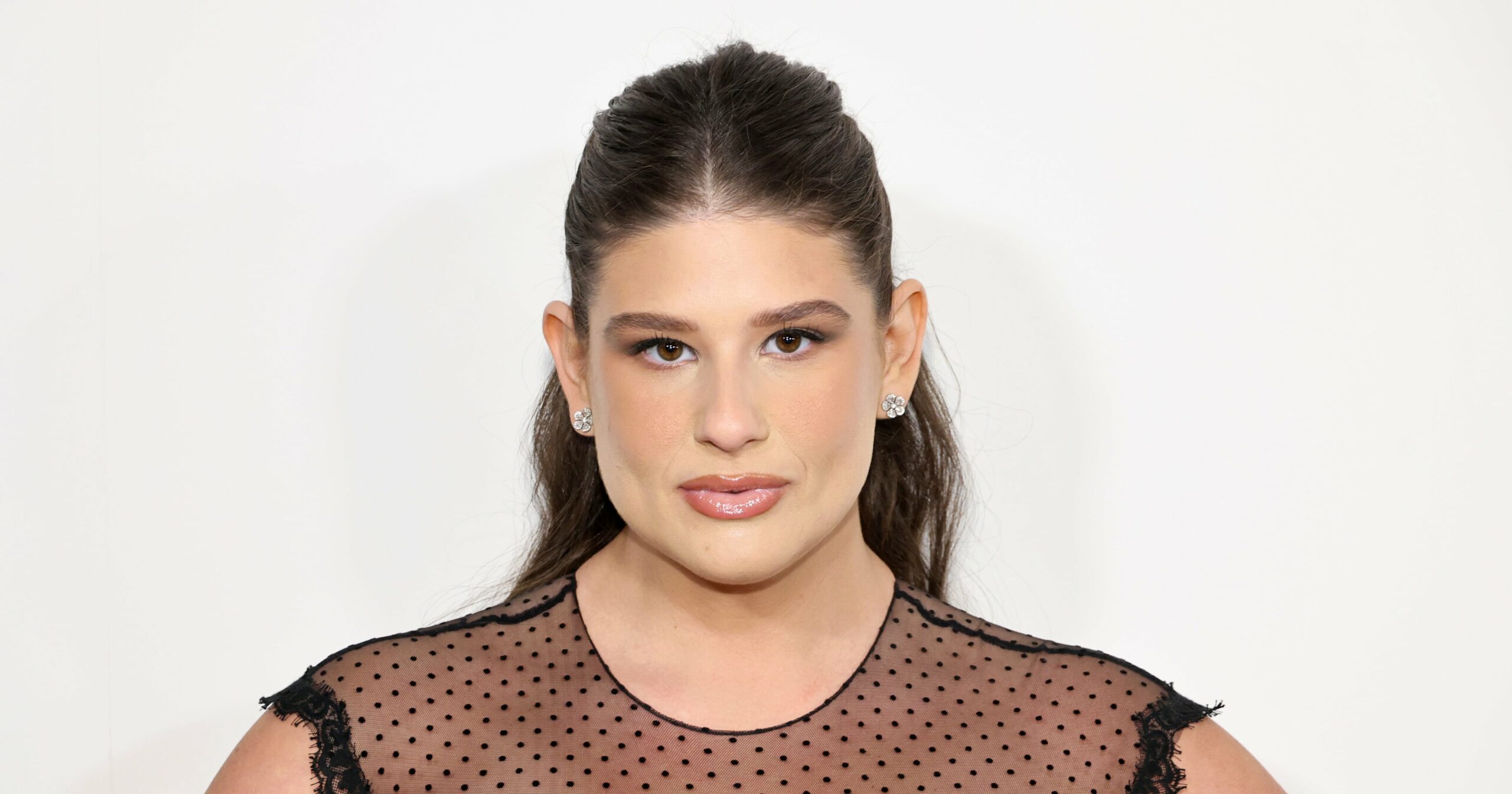 i-got-weight-loss-surgery-like-remi-bader-–-no-one-deserves-the-shame