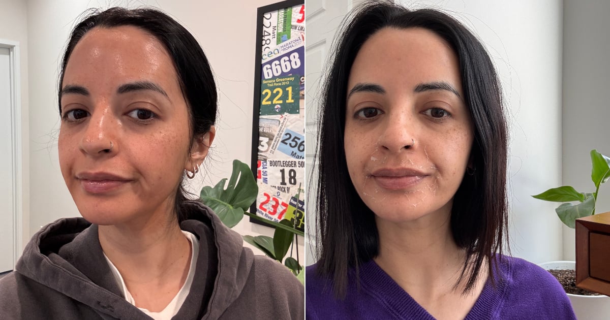 i-tried-a-chemical-peel-for-acne-and-dark-spots-–-now,-it’s-my-holy-grail