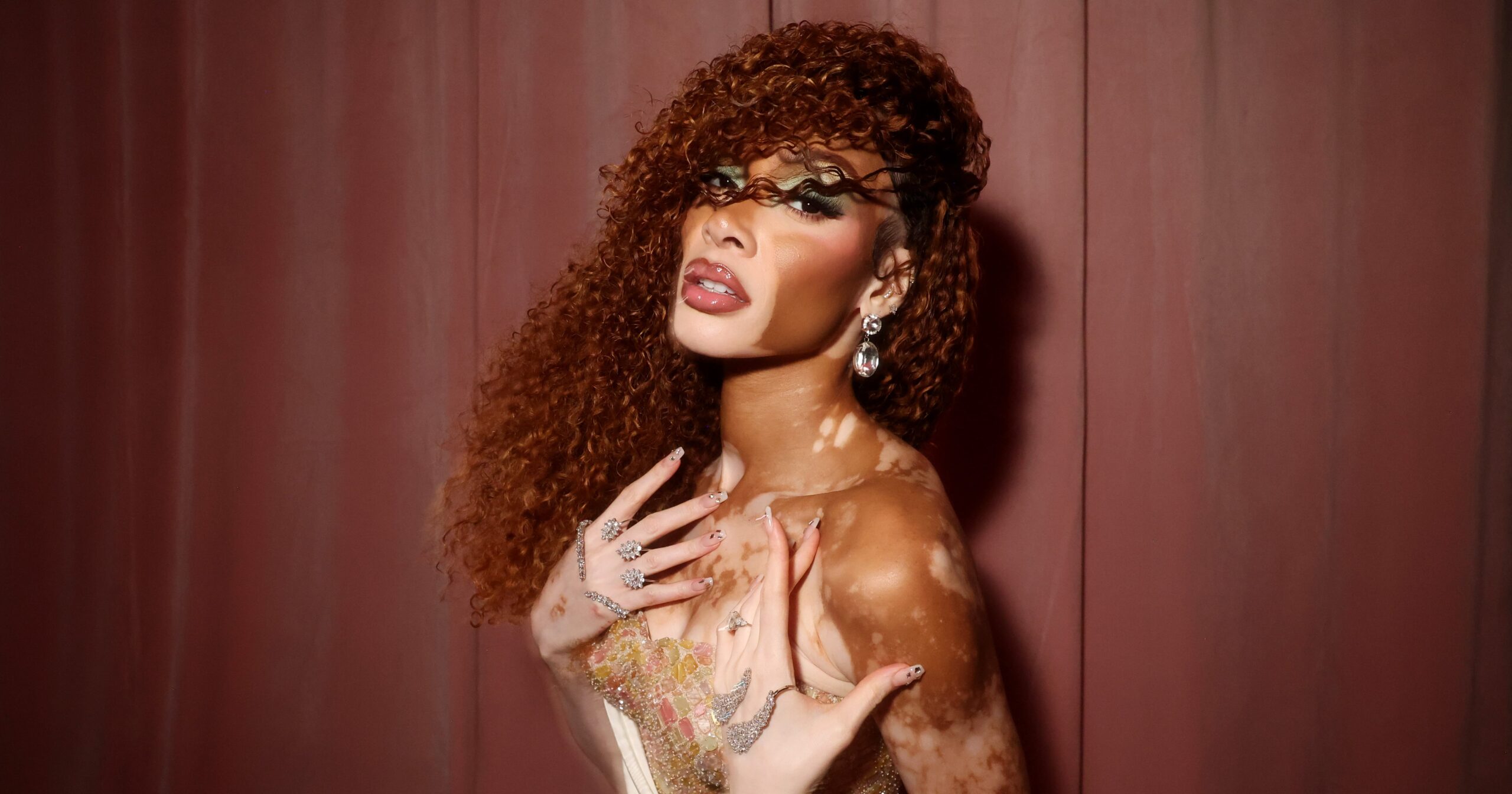 winnie-harlow-has-some-(inner)-beauty-advice