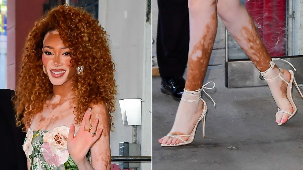 winnie-harlow-takes-spring’s-wrap-sandal-revival-in-a-softer-direction-in-new york