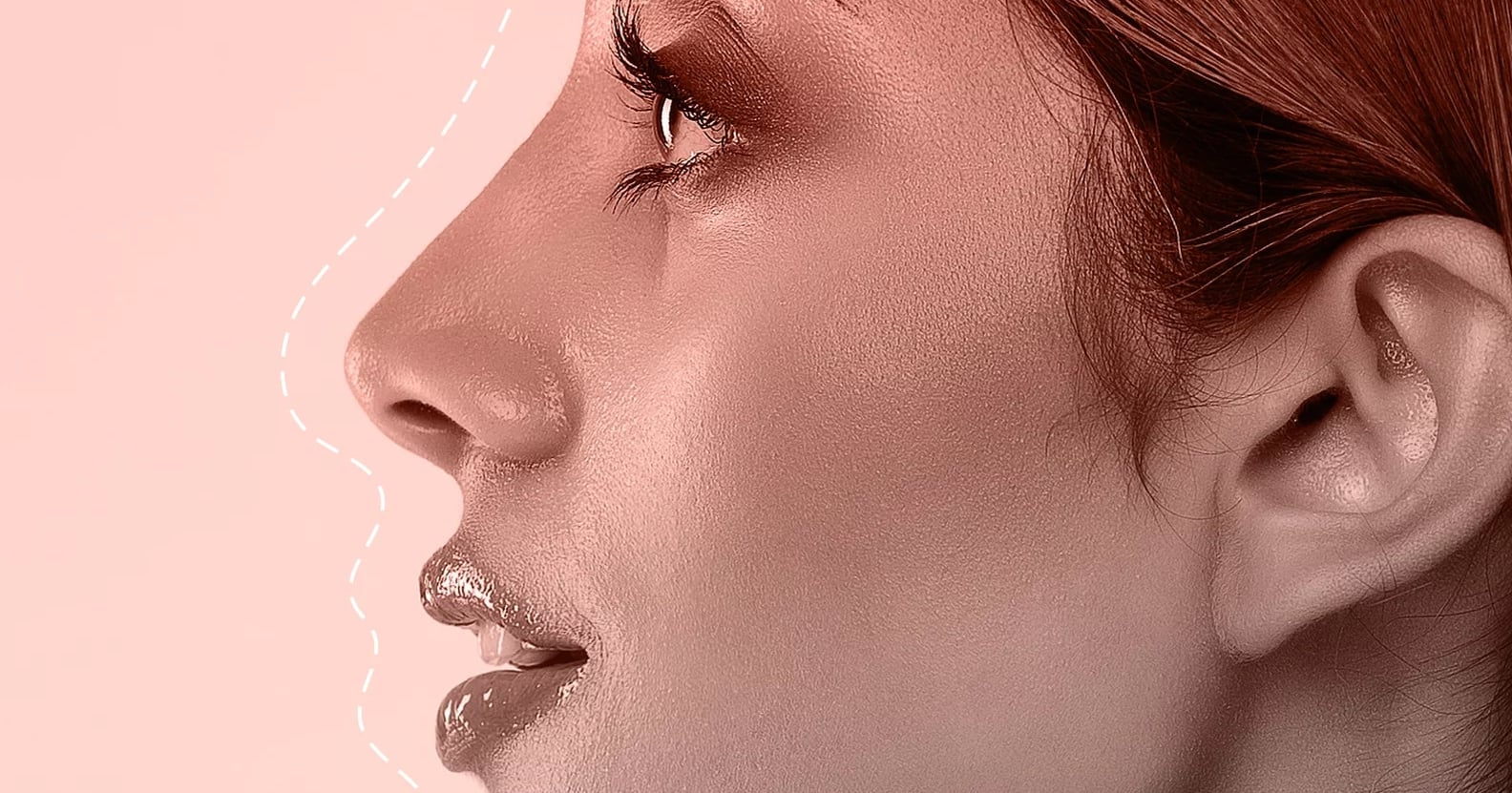 is-your-ai-nose-job-setting-you-up-for-disappointment?